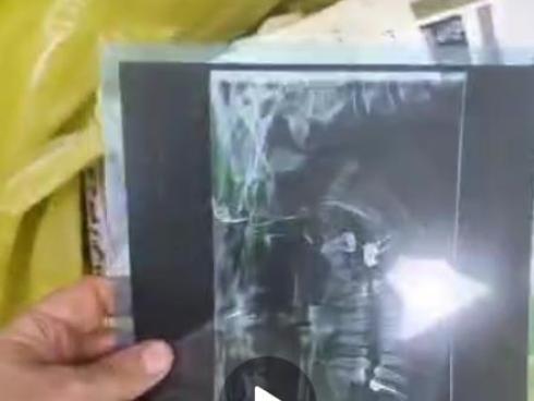 خریدار ضایعات رادیولوژی و رادیو گرافی در سراسر تهران