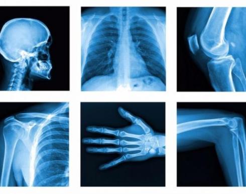 خریدار ضایعات عکس های رادیولوژی نقدا تا 500 کیلو