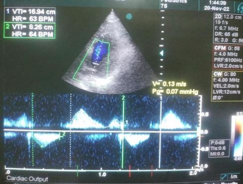 فروش پروب های سونوگرافی