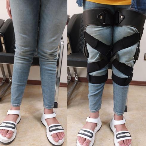 درمان زانو ضربدری در شهرک غرب