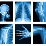 خریدار ضایعات عکس های رادیولوژی نقدا تا 500 کیلو