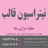 نیتراسیون قالب