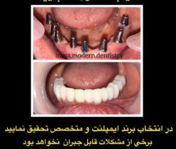 مرکز تخصصی ایمپلنت و جراحی فک